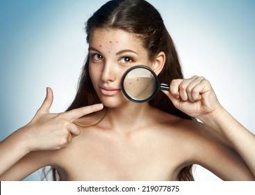 Teen girl with problem skin look at pimple with magnifying glass. Woman skin care concept. Photo of Latina girl on blue background  