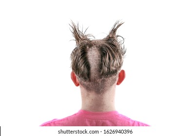 Teen with an odd bad haircut