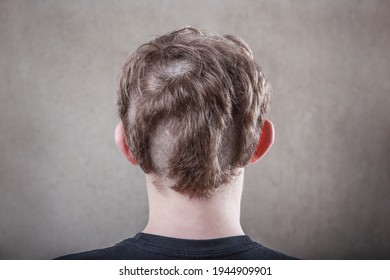 Teen With An Odd Bad Haircut, Poor Quality Haircut