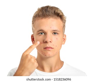 4,170 Children acne Images, Stock Photos & Vectors | Shutterstock