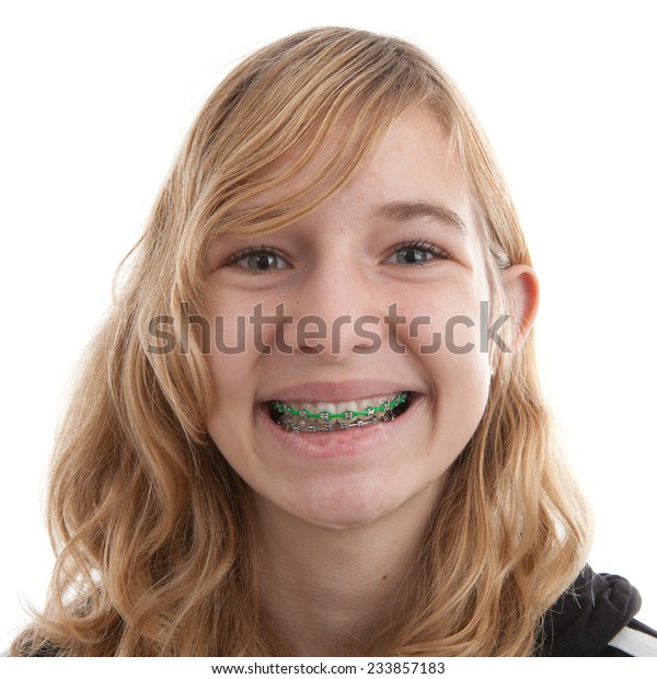 Young Girls With Braces On Teeth