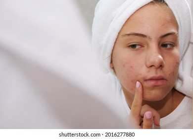 A teenage girl in a white towel on her head is looking at her face with problem skin in the mirror. Acne. - Shutterstock ID 2016277880