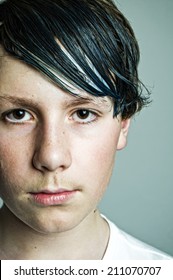 Teenaged Boy With Greasy Hair