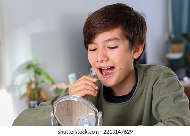 Teenager Boy With Diastema Overbite Teeth Missing Gap Problem Wearing Orthodontic Appliance Treatment Infant Of The Mirror. Dental Braces And Child Tooth Care Concept.