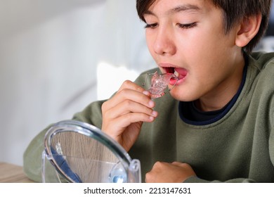 Teenager Boy With Diastema Overbite Teeth Missing Gap Problem Wearing Orthodontic Appliance Treatment Infant Of The Mirror. Dental Braces And Child Tooth Care Concept.