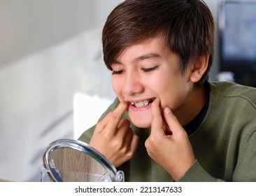 Teenager Boy With Diastema Overbite Teeth Missing Gap Problem Wearing Orthodontic Appliance Treatment Infant Of The Mirror. Dental Braces And Child Tooth Care Concept.