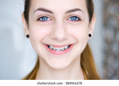 Teeth With Braces.