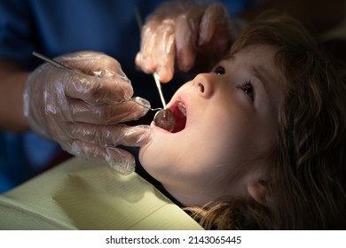 Teeth Checkup At Dentists, Examining Teeth Close Up. Dentist Examining Kids Teeth In The Dentists Chair. Close-up Dentist Procedure Of Kids Teeth.