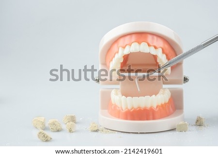 Teeth model with dental plaque tool ,Concept Dental care cleaning bacterial plaque and scaling tartar