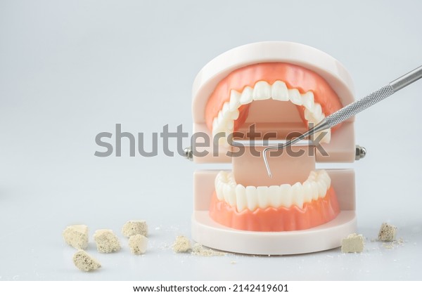 Teeth model with\
dental plaque tool ,Concept Dental care cleaning bacterial plaque\
and scaling tartar