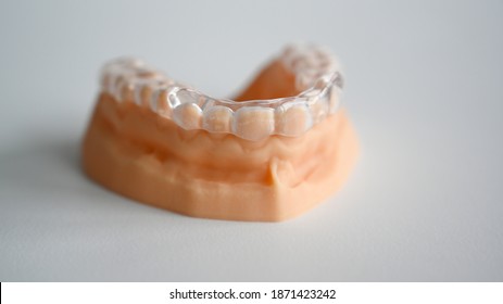 A Teeth Model With Dental Splint