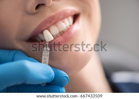 Teeth model locating near brilliant woman smile