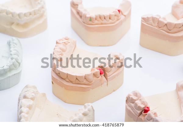 Teeth molds on a bright\
white surface