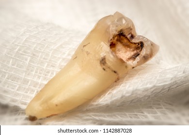 Permanent Teeth Images, Stock Photos & Vectors | Shutterstock