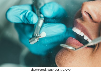 Teeth Polishing, dental procedure