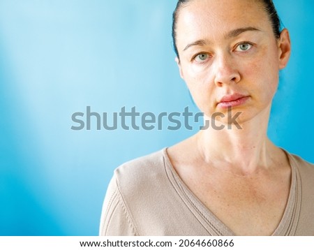 Teeth Problem. Gumboil, flux, bruise and swelling of cheek. Closeup Of Beautiful Sad Woman with swollen cheeks. Attractive Female Feeling Painful Toothache, Dental Health And Care Concept