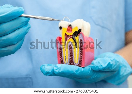 Teeth root dental model with tool for dentist use to cleaning care treatment.