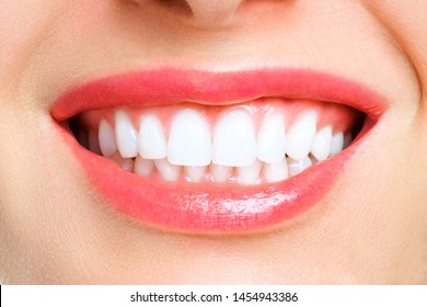 Teeth Whitening. Woman Smile. Dentistry, stomatology concept