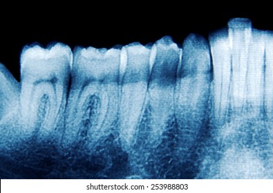 Teeth Xray Scan Closeup