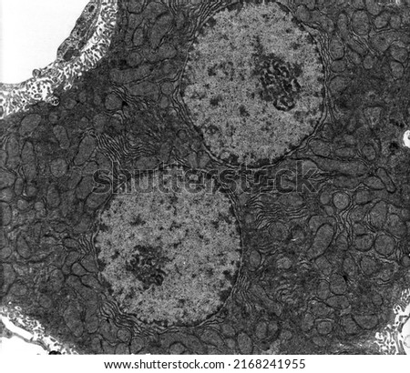 TEM micrograph showing a binucleated hepatocyte with many mitochondria and elongated cisterns of rough endoplasmic reticulum (RER). The space of Disse full of microvilli appear at three corners