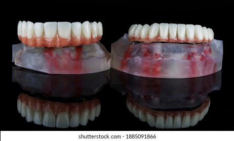 Temporary Wearing Dentures Of The Lower And Upper Jaws With Pink Gums On Dental Models, Removed On Black Glass With Excellent Reflection