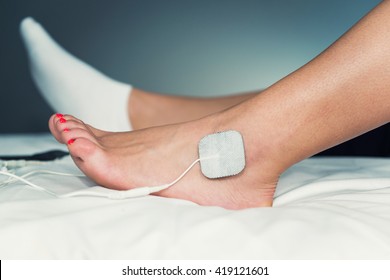 TENS treatment in physical therapy - electrodes placed onto patient's foot