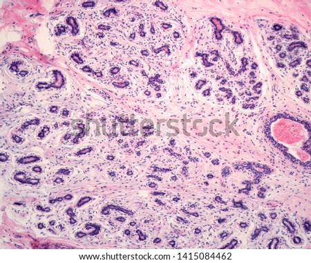 A terminal duct-lobular unit (TDLU) with regular acinar structures and a small segment of extralobular duct. The stroma is a connective tissue looser and more cellular than the interlobular stroma.  Stock photo © 