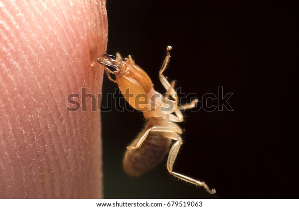 Termite bite finger on\
black background
