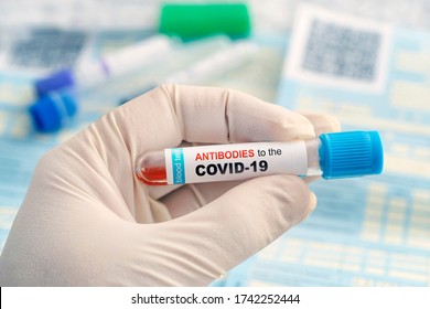 Test for antibodies to coronavirus infection. Checking the population for immunity to covid 19. A test tube with a blood test in the hands of a doctor against the background of laboratory research.