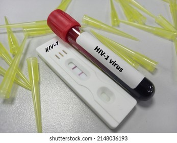 Test Kit With Blood Sample For HIV-1 Test, HIV Screening Test.