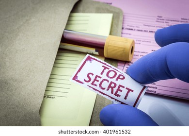 Test for Research of blood, top secret - Shutterstock ID 401961532
