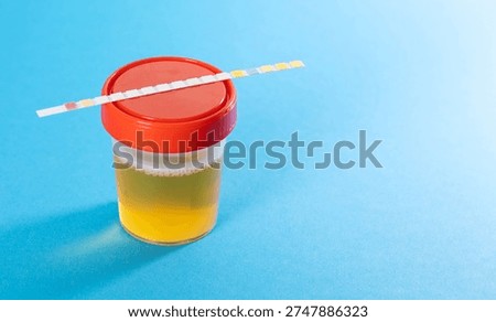 Test strips on a blue background with a urine test jar. Concept of rapid urine analysis with test strips for determining the density and acidity of urine, as well as red and white blood cells in the urine.