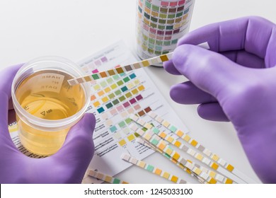 Test tires in violet gloves with test chart and urine can