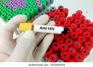 Test Tube With Blood For Anti-HIV Test, Hiv Screening Test