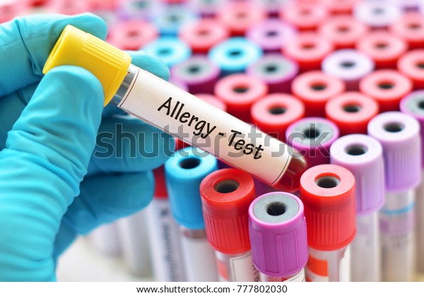 Test tube with\
blood sample for allergy\
test