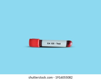 Test Tube With Blood Sample For CA 125 Test. Tumor Marker For Ovarian Cancer. A Medical Testing Concept In The Blue Background.