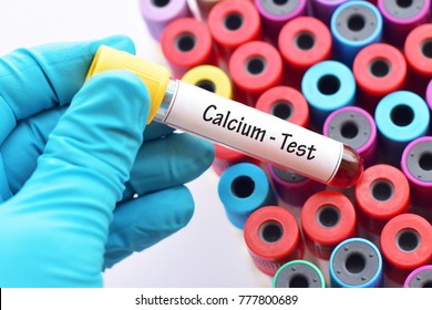 Test Tube With Blood Sample For Calcium Test