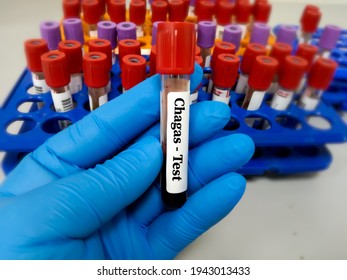 Test Tube with blood sample for Chagas test, (American trypanosomiasis). Diagnosis of Chagas disease. A medical testing concept in the laboratory background.