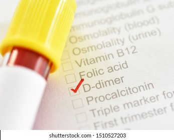 Test Tube With Blood Sample For D-dimer Test, Diagnosis For Disseminated Intravascular Coagulation