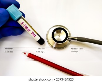 Test Tube With Blood Sample For D-dimer Test With Abnormal High Report. Diagnosis For Disseminated Intravascular Coagulation