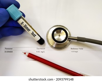 Test Tube With Blood Sample For D-dimer Test With Abnormal High Report. Diagnosis For Disseminated Intravascular Coagulation