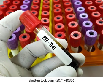 Test Tube with blood sample for EBV-VCA IgG (Epstein-Barr virus). A medical testing concept in the laboratory background.