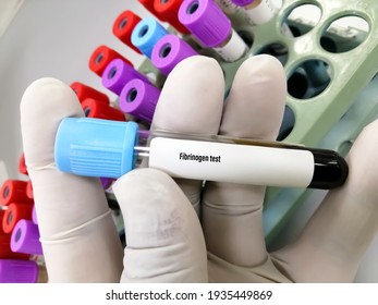 Test Tube With Blood Sample For Fibrinogen Test, Coagulation Disorder Diagnosis