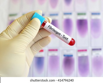 Test Tube With Blood Sample For Fibrinogen Test, Coagulation Disorder Diagnosis