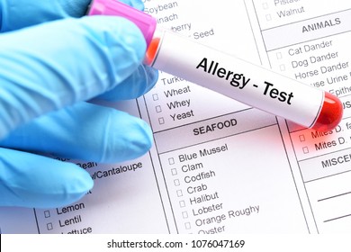 Test Tube With Blood Sample For Food Allergy Test