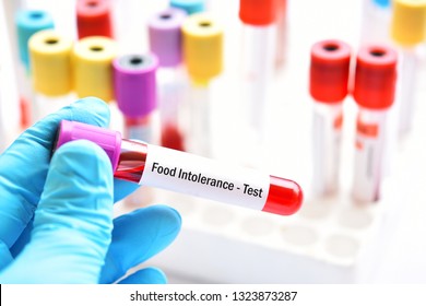 Test Tube With Blood Sample For Food Intolerance Test