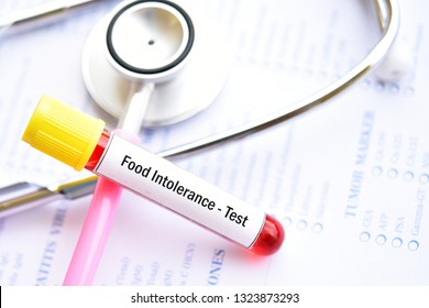 Test Tube With Blood Sample For Food Intolerance Test