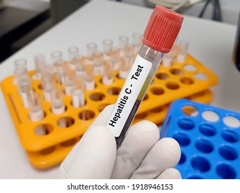 Test Tube With Blood Sample For Hepatitis C Virus (HCV) Testing, Anti-hcv. A Medical Testing Concept In The Laboratory Background.