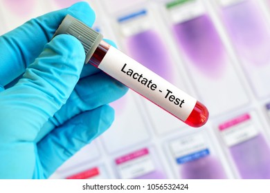 Test tube with blood sample for lactate test