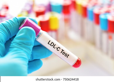 Test tube with blood sample for LDL-cholesterol test